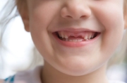 Portrait of a little girl shows off her missing teeth.  Chicago photographer Alex Garcia